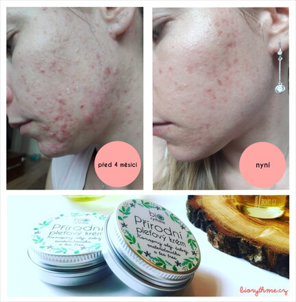 Přírodní pleťový krém "Anti-pupínek" - Konopný olej, šalvěj, mateřídouška a tea tree